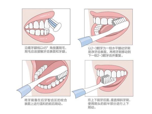 电动牙刷如何配巴氏刷牙法
