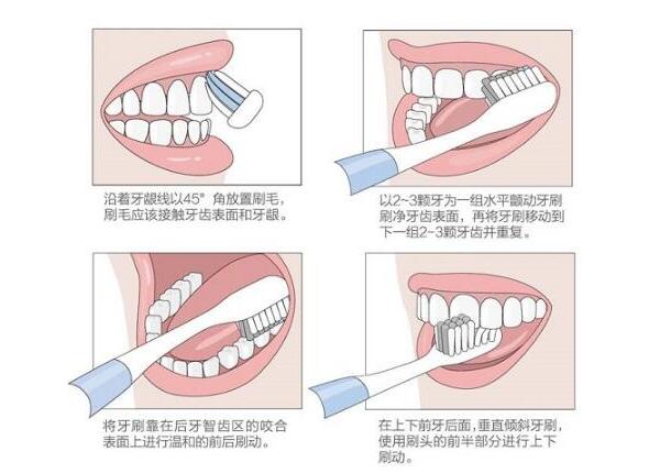 圆头声波电动牙刷刷牙方法 圆头声波电动牙刷刷牙方法之巴氏刷牙法