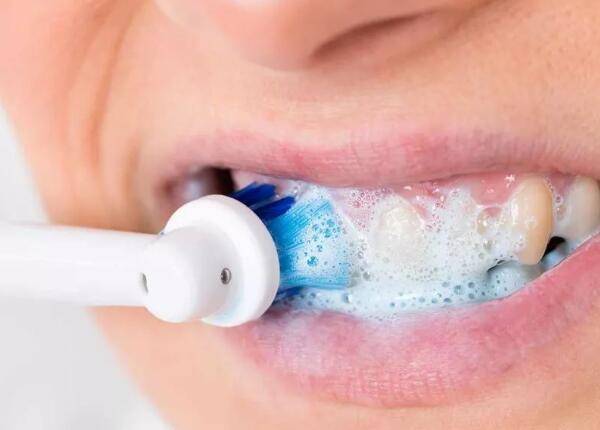 成人声波电动牙刷 成人声波电动牙刷有哪些好处