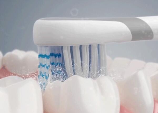 电动牙刷刷牙好吗？真的比手动牙刷更好吗？