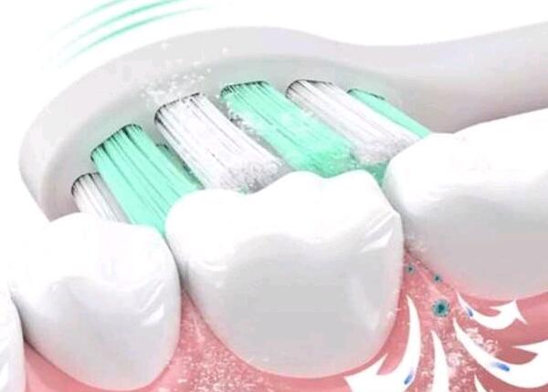 合适牙刷头选择 合适牙刷头选择