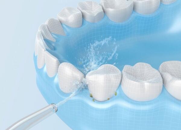 电动冲牙器的正确使用方法 电动冲牙器的正确使用方法